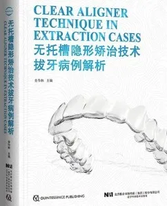 无托槽隐形矫治技术拔牙病例解析