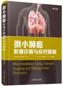 微小肺癌影像诊断与应对策略 修订版