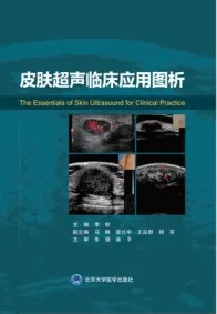 皮肤超声临床应用图析