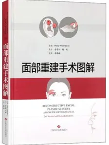 面部重建手术图解
