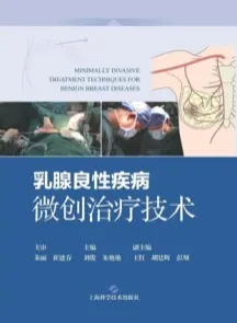 乳腺良性疾病微创治疗技术