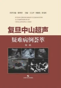 复旦中山超声疑难病例荟萃（第一辑）