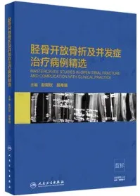 胫骨开放骨折及并发症治疗病例精选