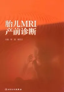 胎儿MRI产前诊断