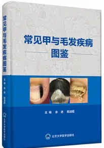 常见甲与毛发疾病图鉴