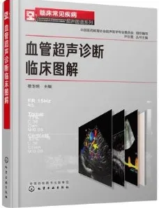 血管超声诊断临床图解