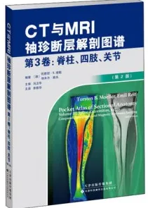 CT与MRI袖珍断层解剖图谱 第3卷 脊柱、四肢、关节
