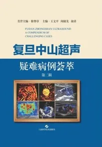 复旦中山超声疑难病例荟萃（第二辑）