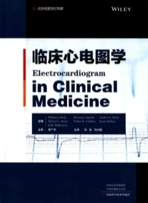 临床心电图学