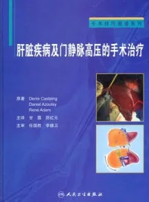 肝脏疾病及门静脉高压的手术治疗
