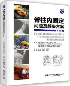 脊柱内固定问题及解决方案 第2版