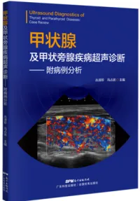 甲状腺及甲状旁腺疾病超声诊断 附病例分析