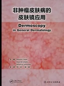 非肿瘤皮肤病的皮肤镜应用