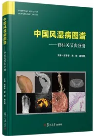 中国风湿病图谱 脊柱关节炎分册