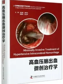 高血压脑出血微创治疗学