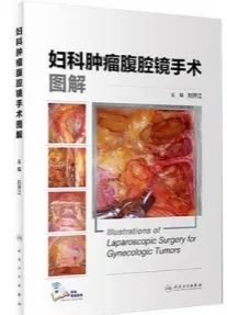 妇科肿瘤腹腔镜手术图解
