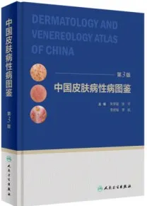 中国皮肤病性病图鉴 第3版