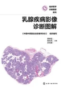 乳腺疾病影像诊断图解