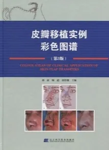 皮瓣移植实例彩色图谱 第3版