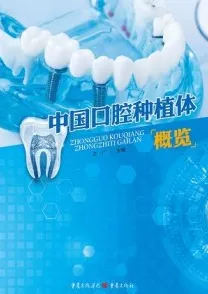中国口腔种植体概览
