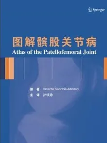 图解髌股关节病