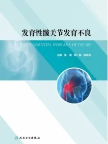发育性髋关节发育不良