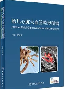 胎儿心脏大血管畸形图谱