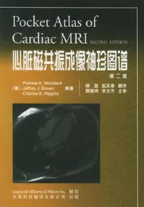心脏磁共振成像袖珍图谱（第2版）