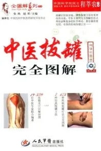 中医拔罐完全图解