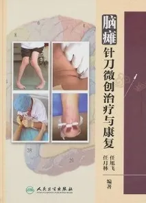 脑瘫针刀微创治疗与康复