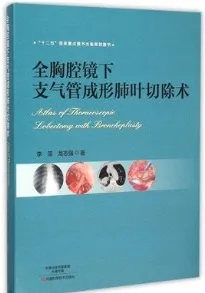 全胸腔镜下支气管成形肺叶切除术