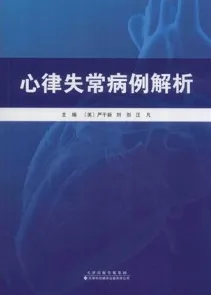 心律失常病例解析