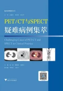 PET CT与SPECT疑难病例集萃