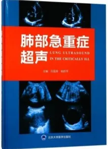 肺部急重症超声