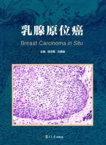 乳腺原位癌