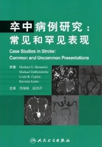 卒中病例研究 常见和罕见表现