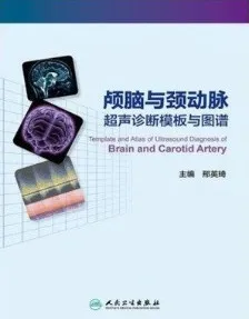 颅脑与颈动脉超声诊断模板与图谱