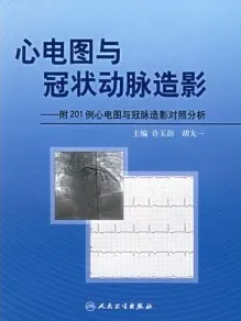 心电图与冠状动脉造影