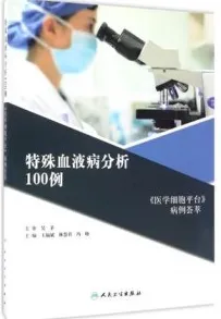 特殊血液病分析100例