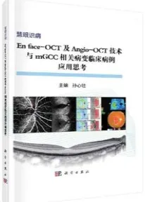 En face-OCT及Angio-OCT技术与mGCC相关病变临床病例应用思考