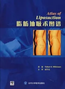 脂肪抽吸术图谱
