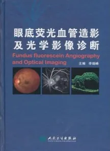 眼底荧光血管造影及光学影像诊断