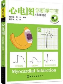 心电图诊断掌中宝（彩图版）