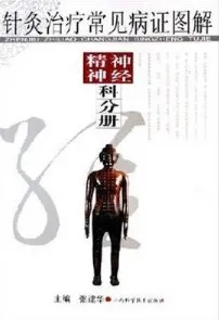 针灸治疗常见病证图解 神经、精神科分册