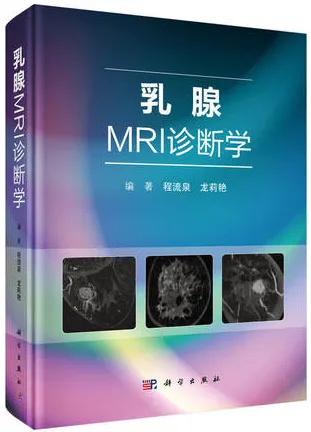 乳腺MRI诊断学
