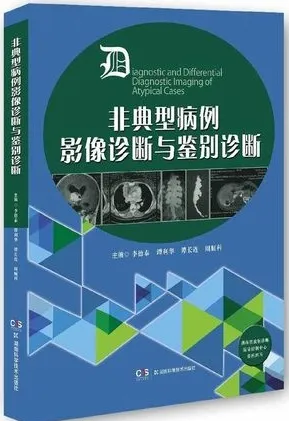 非典型病例影像诊断与鉴别诊断