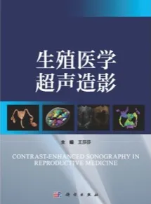 生殖医学超声造影