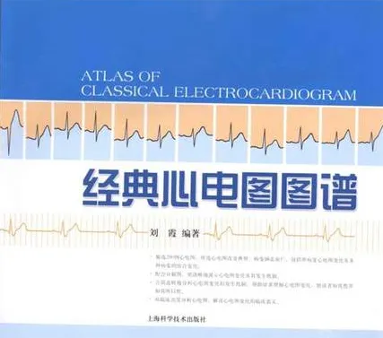 经典心电图图谱