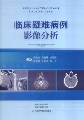 临床疑难病例影像分析