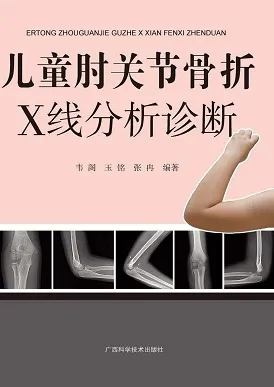 儿童肘关节骨折X线分析诊断